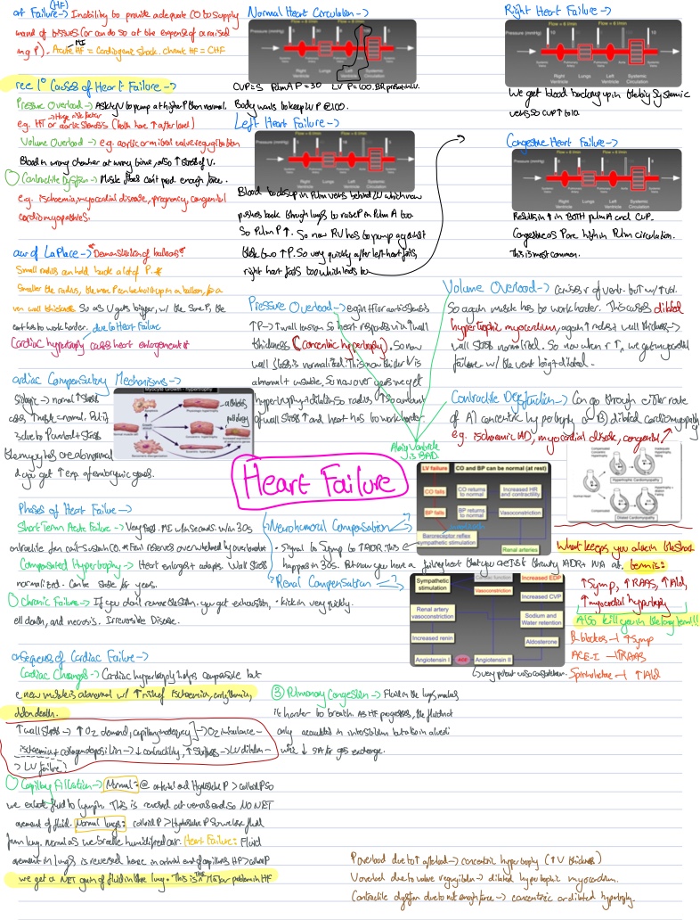 Acute Heart Failure Cardiogenic Shock Notability Gallery