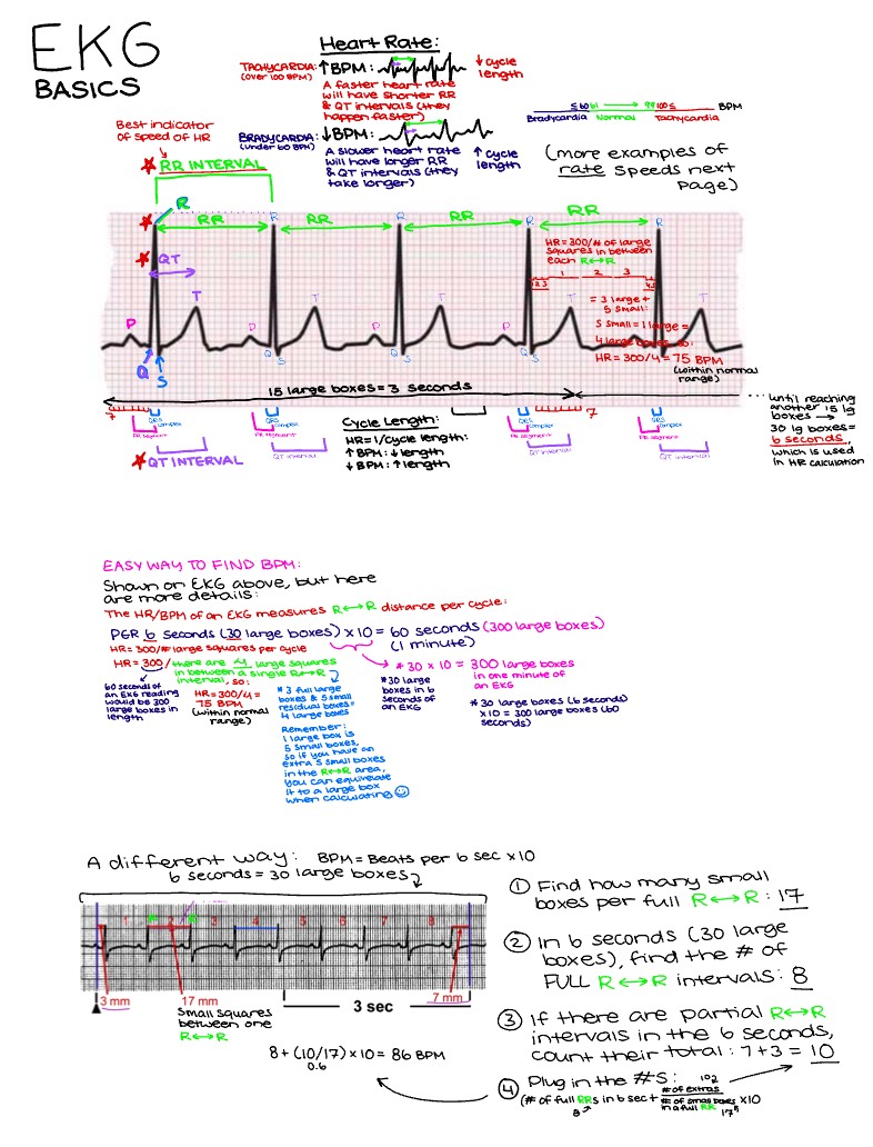 EKG BPM Basics - Notability Gallery