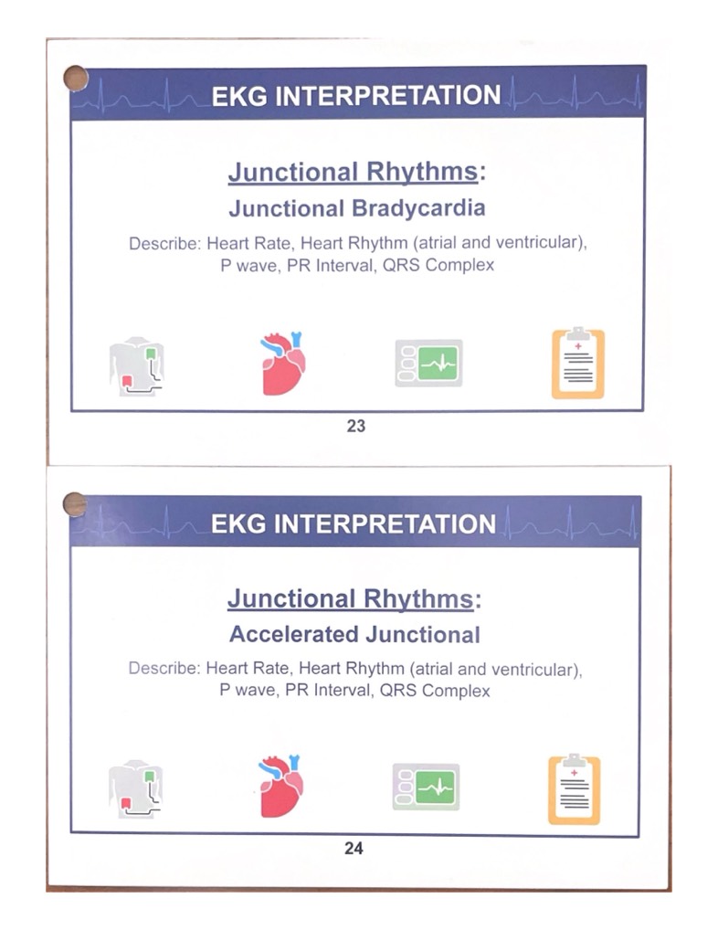 EKG INTERPRETATION Flashcards Printable - Notability Gallery
