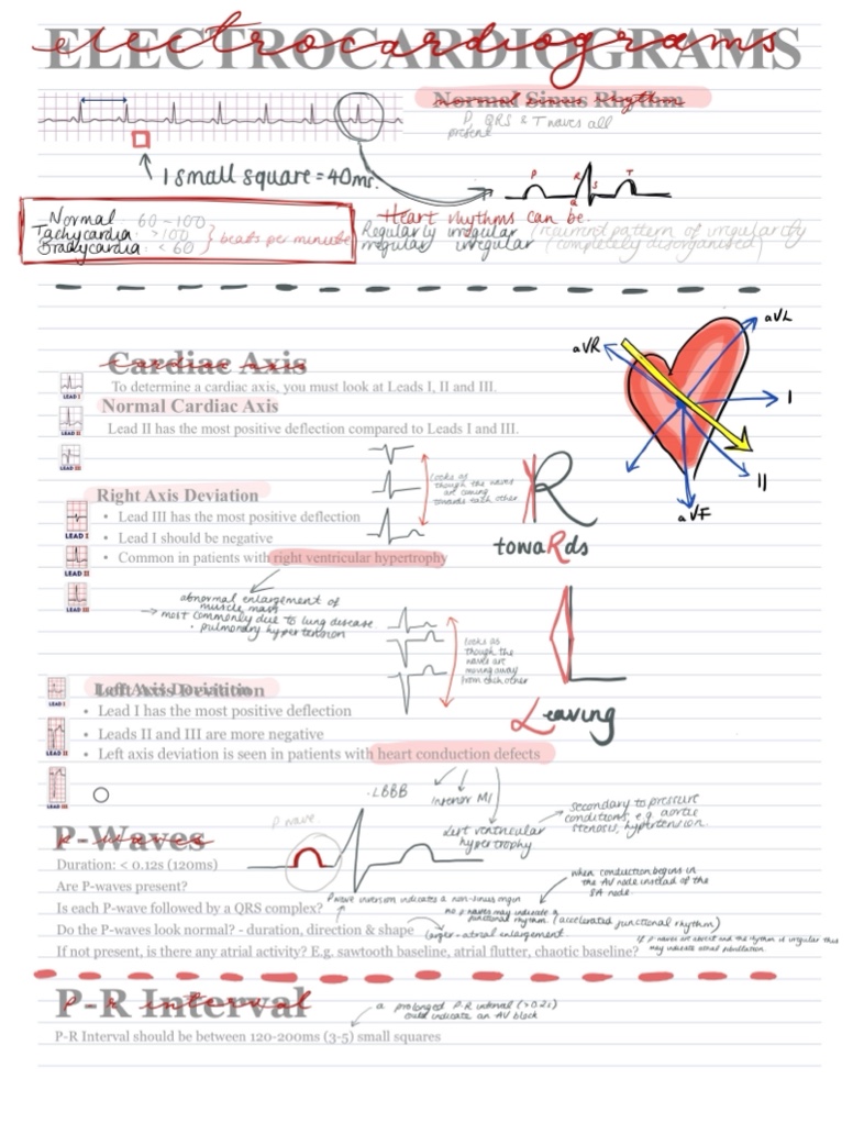 EKG Study Guide - Notability Gallery