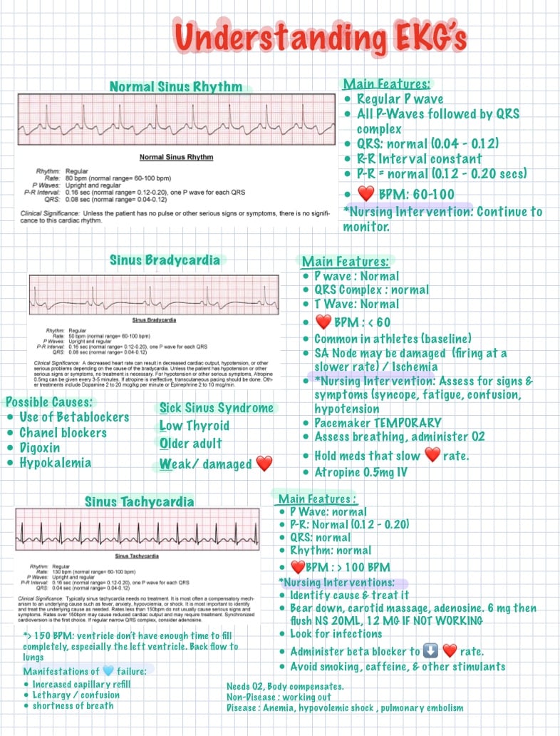 Understanding EKG’s - Notability Gallery