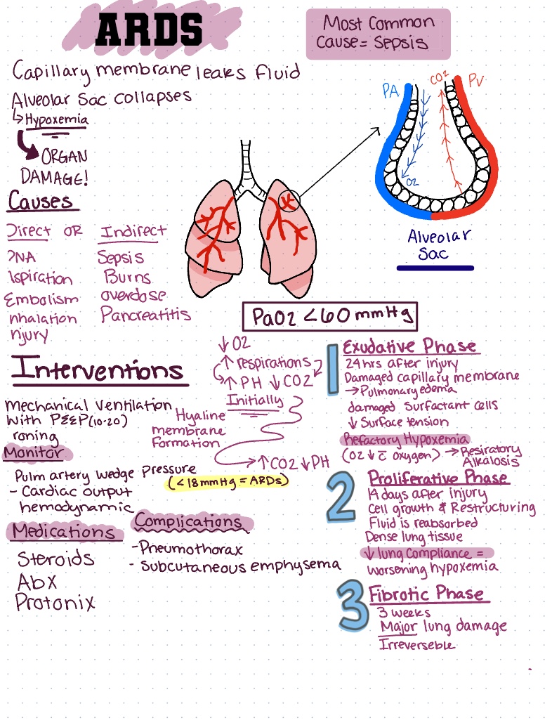 ARDS - Notability Gallery