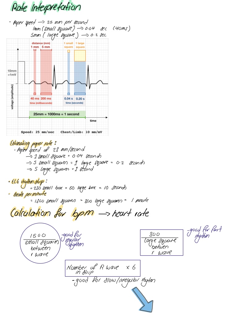 EKG Basics - Notability Gallery