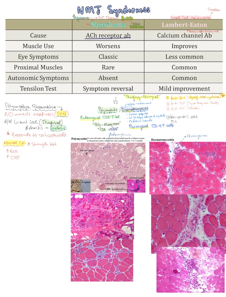 NMJ And Other Similar Conditions USMLE - Notability Gallery