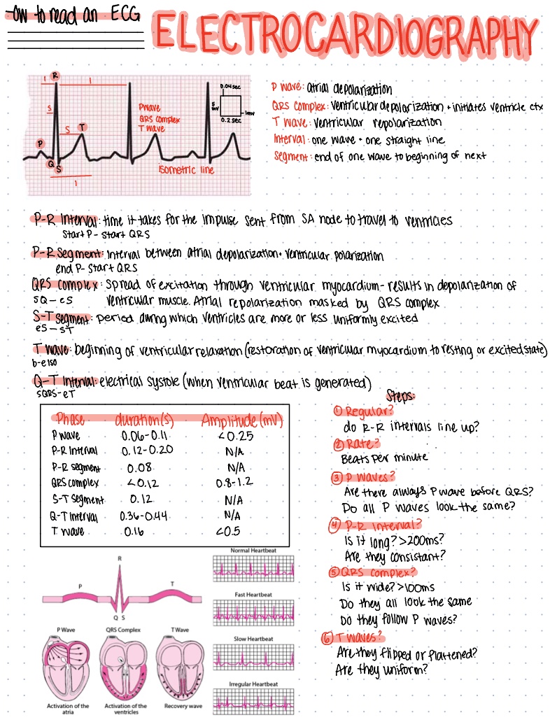 How To Read Ecg - Notability Gallery